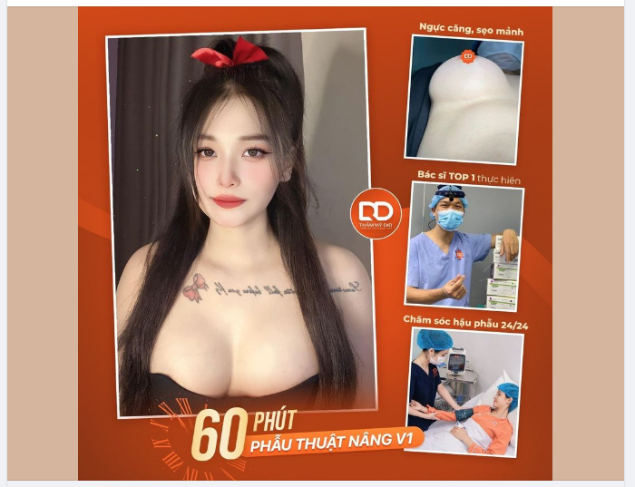 60 PHÚT NÂNG V1 CHUẨN AN TOÀN - 2 NGÀY HỒI PHỤC - 10 NGÀY ĐẸP TỰ NHIÊN