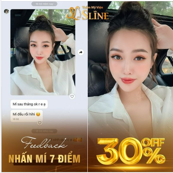 GIẢM NGAY 30%...cho dịch vụ nhấn mí khi khách hàng đăng ký combo 2 dịch vụ làm đẹp trong tháng này