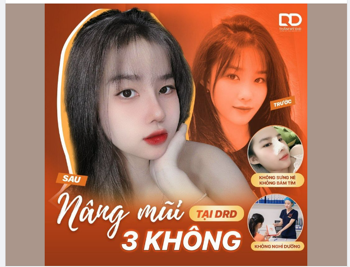 NÂNG MŨI 3 KHÔNG TẠI DrD KHÔNG ĐAU: