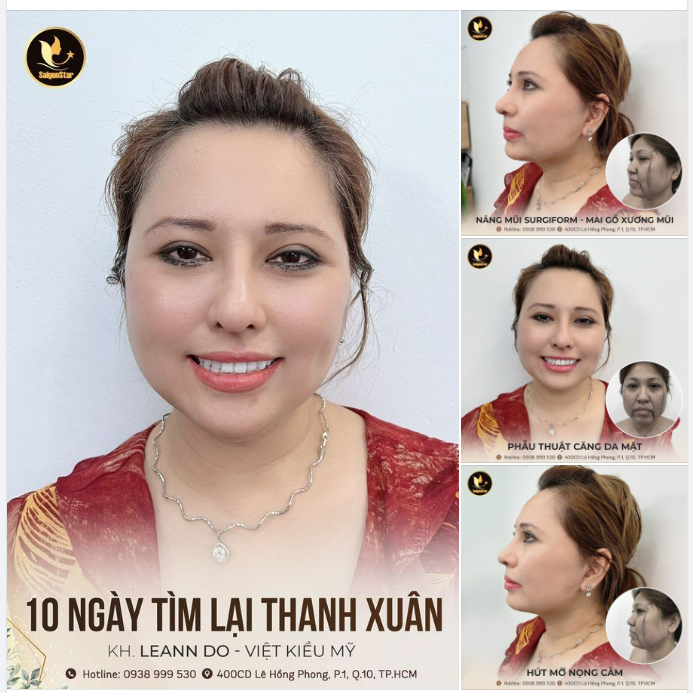 10 NGÀY TÌM LẠI THANH XUÂN CÙNG CHỊ LEANN DO (VIỆT KIỀU MỸ)