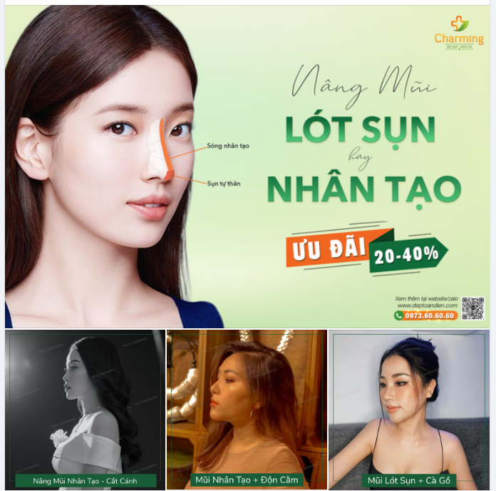 ĐIỀU GÌ LÀM "CẶP CHỊ EM" NÂNG MŨI NHÂN TẠO VÀ NÂNG MŨI LÓT SỤN KHÁC NHAU?