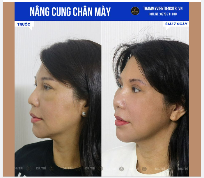SỞ HỮU CUNG MÀY ĐẸP SẮC NÉT SAU 7 NGÀY