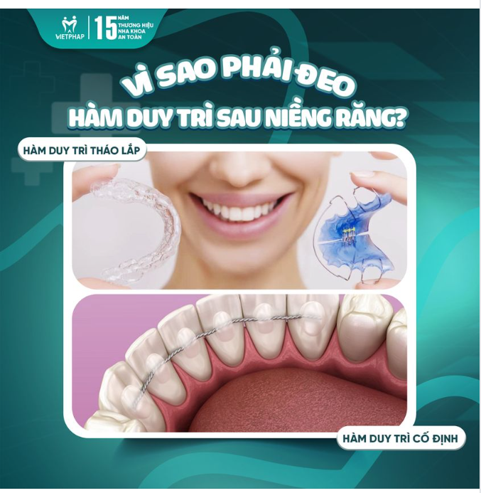 VÌ SAO PHẢI ĐEO HÀM DUY TRÌ SAU NIỀNG RĂNG