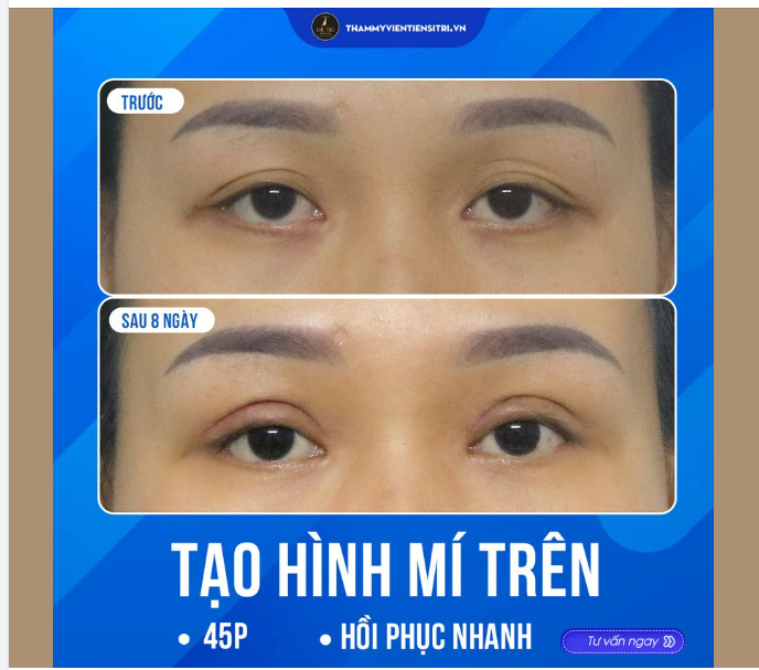 CHÀO MỪNG LỄ LỚN - HỒI SINH MÍ ĐẸP