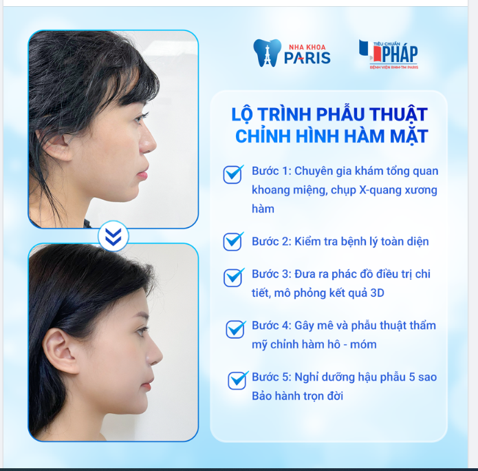PHẪU THUẬT HÀM MẶT TRẢI QUA NHỮNG BƯỚC NÀO?