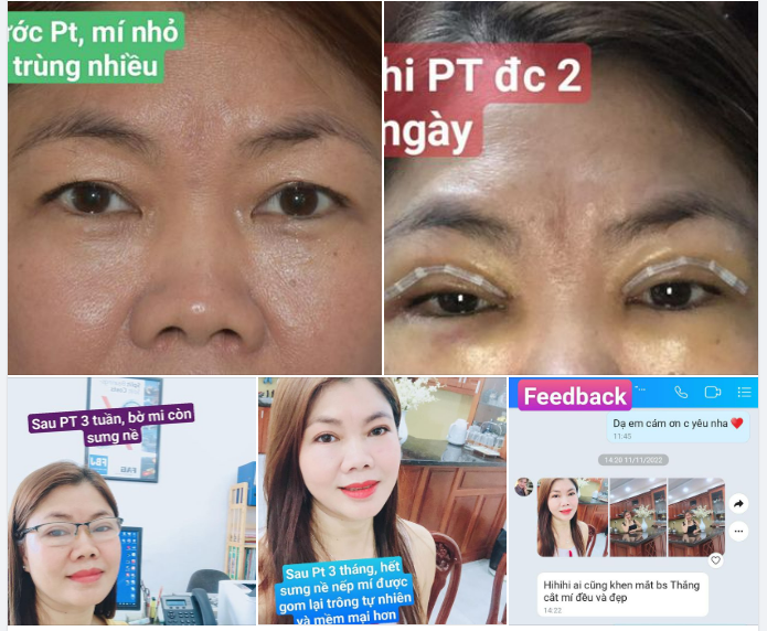 Kể cả trời không nắng, thì MẮT vẫn phải trong. Bản thân tự hạnh phúc, tim vẫn phải rực hồng