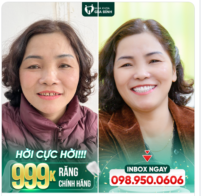 BÂY GIỜ KHÔNG ĐẸP THÌ BAO GIỜ MỚI ĐẸP?
