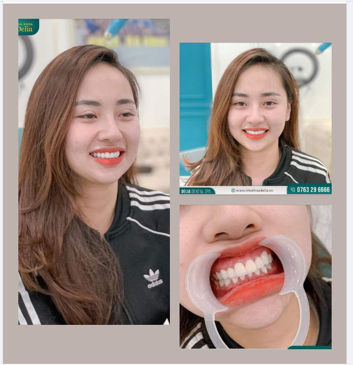 Miệng luôn nở nụ cười, may mắn, hạnh phúc tự nhiên sẽ đến