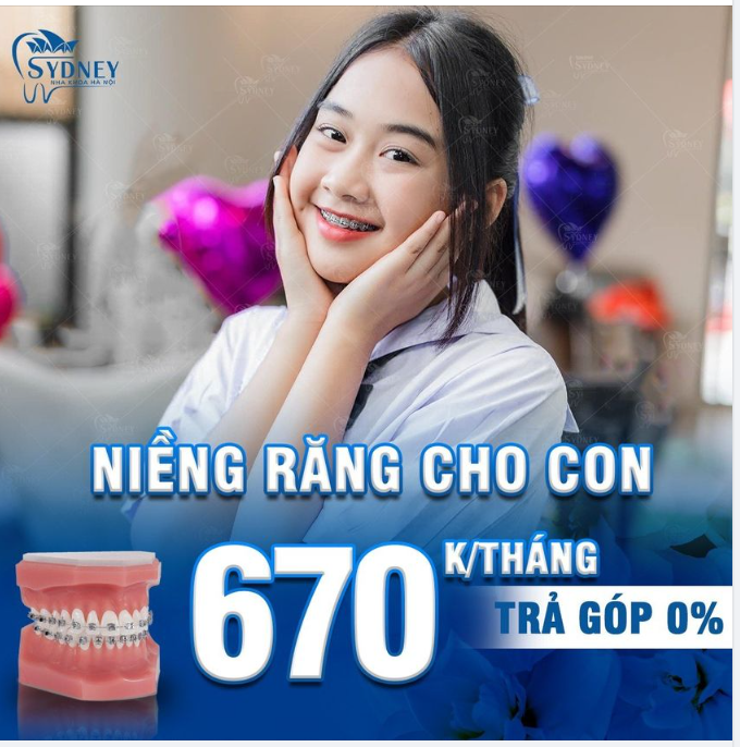 Có nên niềng răng sớm cho con không?