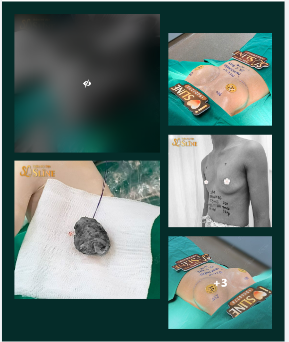 KHÔNG GIỐNG NHỮNG CA NÂNG CẤP VÒNG 1 THÔNG THƯỜNG.