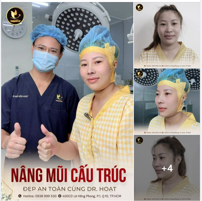 NÂNG MŨI CẤU TRÚC – ĐẸP AN TOÀN CÙNG DR. HOẠT