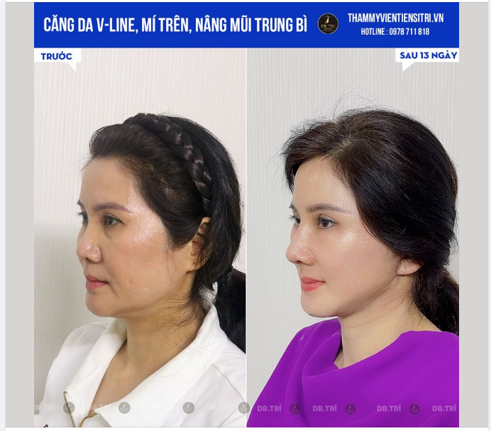 GÓC NGHIÊNG ĐẸP BẤT CHẤP TUỔI TÁC