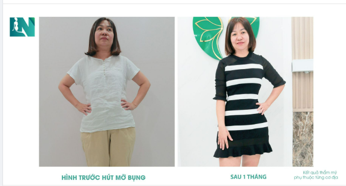NẾU ĐƯỢC LỰA CHỌN; EM CHỌN, DÁNG ĐẸP EO THON!