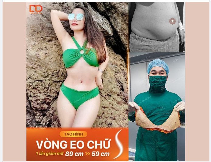 KIẾN TẠO VÒNG EO CHỮ S TỪ 89CM CÒN 59CM
