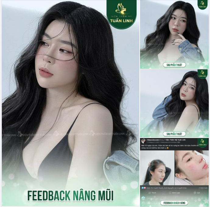 Feedback khách hàng - Dành cho những bạn thích dáng mũi siêu tự nhiên