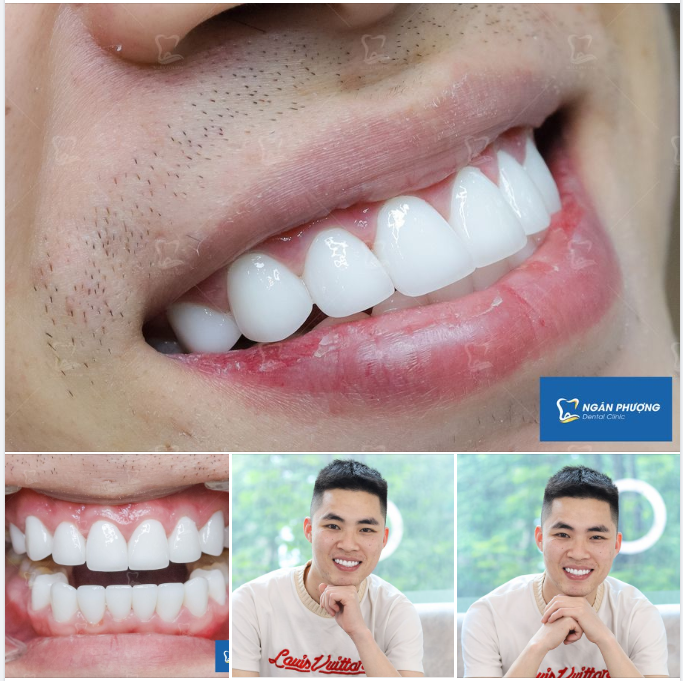 Cảm ơn chia sẻ của anh Công Ước rất nhiều. Đàn ông hiện đại, đâu ngại bảnh bao với nụ cười mới các anh nhỉ