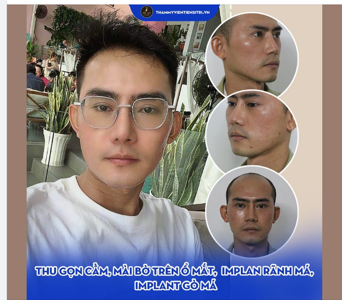BẤT NGỜ VỚI HÌNH ẢNH MỚI CỦA KHÁCH