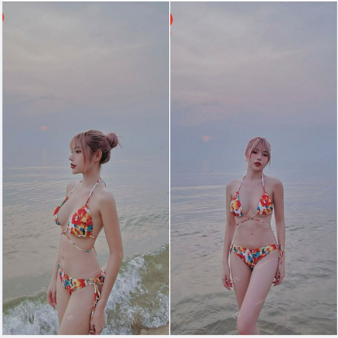 Feedback sau 1 năm phẫu thuật Nâng ngực tại DrD. Body cháy quá cháy. Cô ấy 10 điểm không có nhưng
