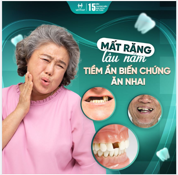 Mất răng lâu năm và tiềm ẩn biến chứng ăn nhai