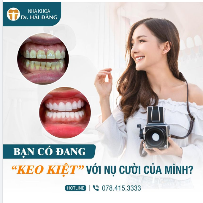 Bọc răng sứ mang lại sắc thái phong thủy chỉ trong 24 giờ!