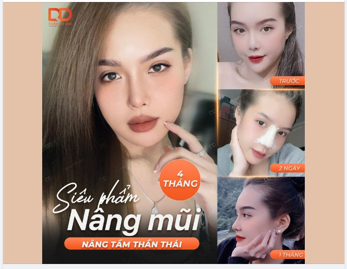 NHẬT KÍ HÀNH TRÌNH 4 THÁNG NÂNG MŨI TẠI DrD