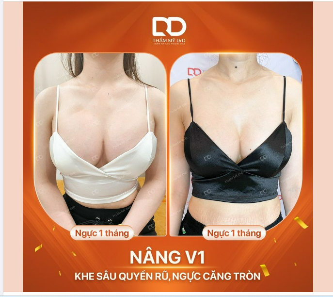 KHE YLINE RÕ NÉT - NGỰC CĂNG TRÒN SEXY