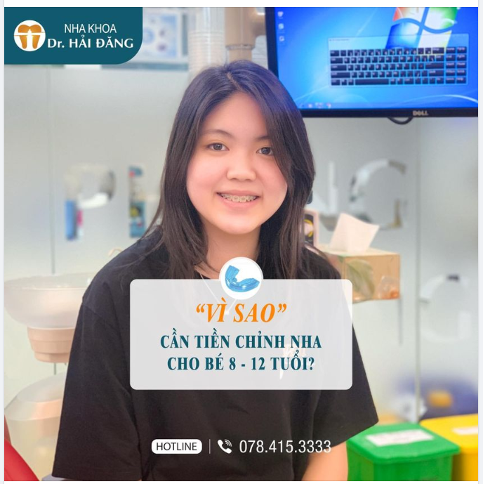 Lợi ích khi tiền chỉnh nha cho trẻ