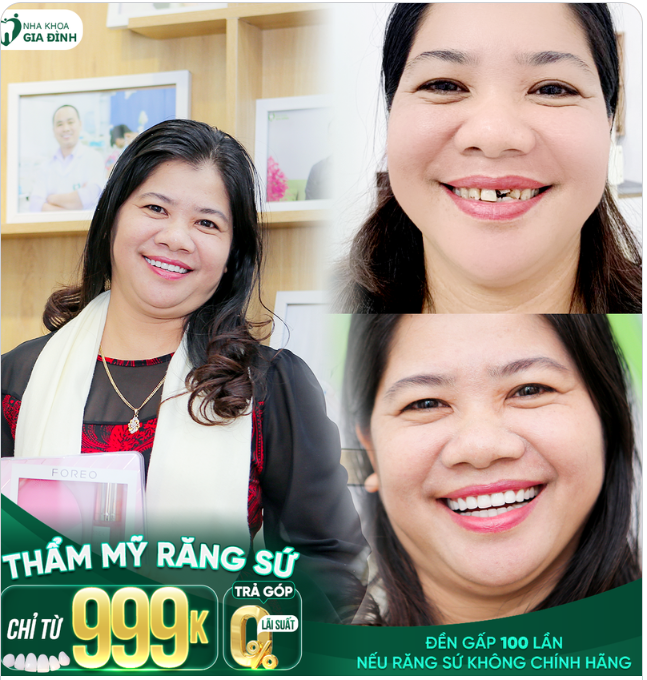 ƯNG NGAY SAU LẦN ĐẦU TRẢI NGHIỆM THẨM MỸ RĂNG SỨ