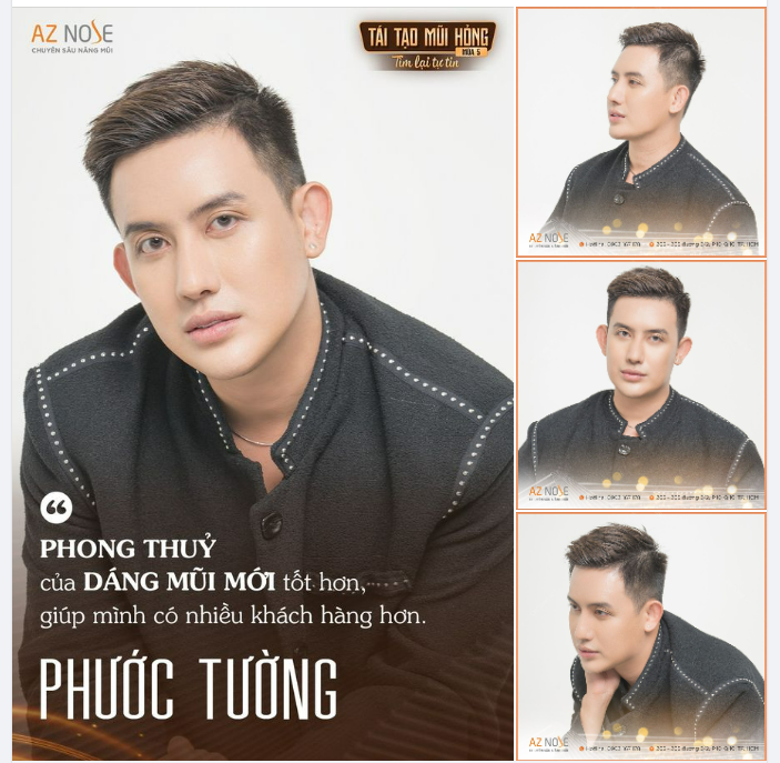 20 năm m.ặc cảm vì "mũi q.uẹo" bẩm sinh,