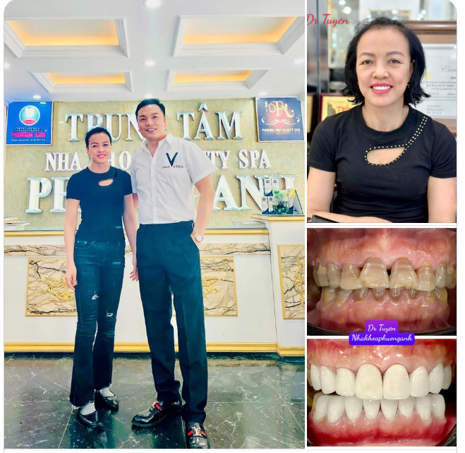 Gắn tạm thôi đã đẹp ntn rồi