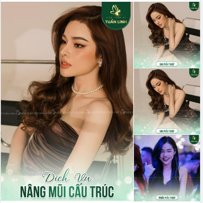 XINH ĐẸP KHÔNG KHÓ - ĐÃ CÓ TUẤN LINH LO.