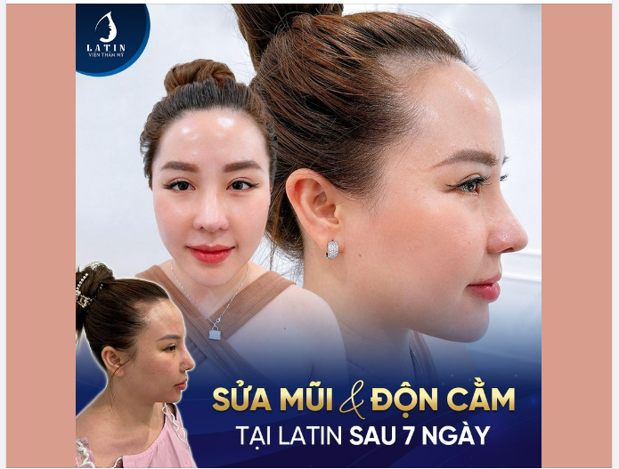 "Ai cũng nói thần thái của chị đã thay đổi, gương mặt sang hơn trước rất nhiều, chị vui lắm."