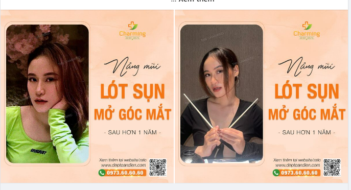Khi bạn gái băn khoăn giữa nâng mũi và cắt cánh để có chiếc mũi đẹp hay chọn mở góc mắt để có một đôi mắt đẹp thì bạn ấy đã quyết định.... CHỌN CẢ HAI