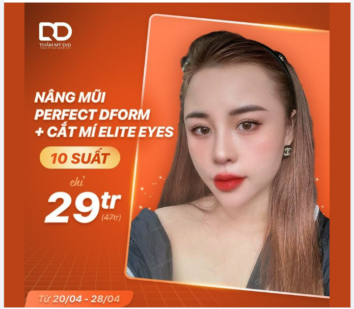 NHẬP HỘI MŨI CAO, MÍ ĐẸP VỚI ƯU ĐÃI SIÊU HỜI