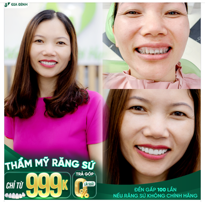 CHIẾM ĐƯỢC THIỆN CẢM CỦA NGƯỜI ĐỐI DIỆN NHỜ NỤ CƯỜI RẠNG RỠ
