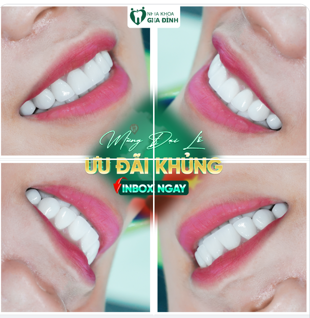 LỄ ĐẾN NƠI RỒI LÀM RĂNG ĐẸP ĐI CHƠI THÔI!!!