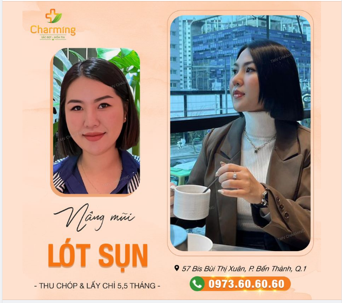 Nhìn em đẹp động tâm can.Anh trông chỉ muốn hỏi han đôi lời.Em ngồi trông dáng thảnh thơi.Em nâng mũi ở nơi nao tuỵt dzời?