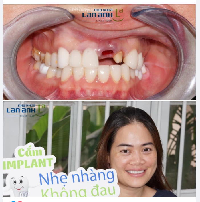 ĐIỀU TRỊ KỸ LƯỠNG, CHĂM SÓC TẬN TÂM