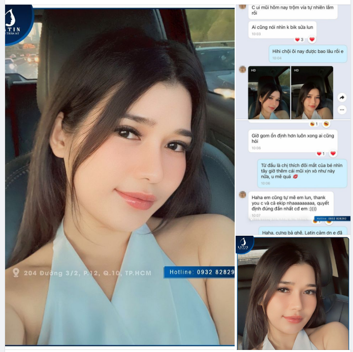 "Nâng mũi là quyết định đúng đắn nhất cuộc đời em"