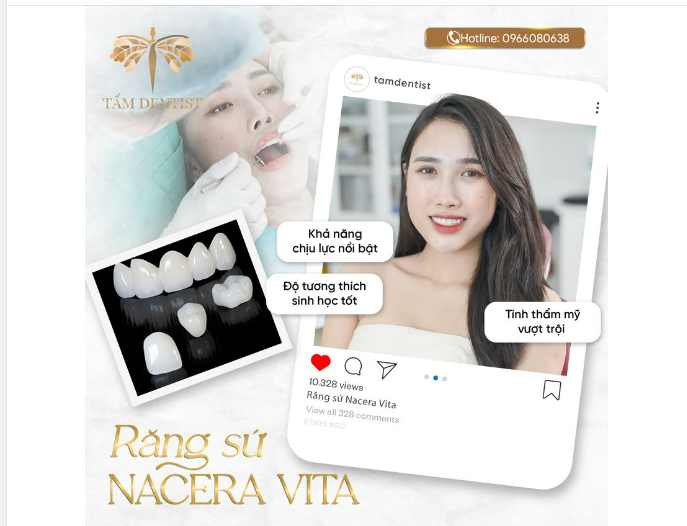 Răng sứ Nacera Vita - Tạo dấu ấn khác biệt cho nụ cười toả sáng