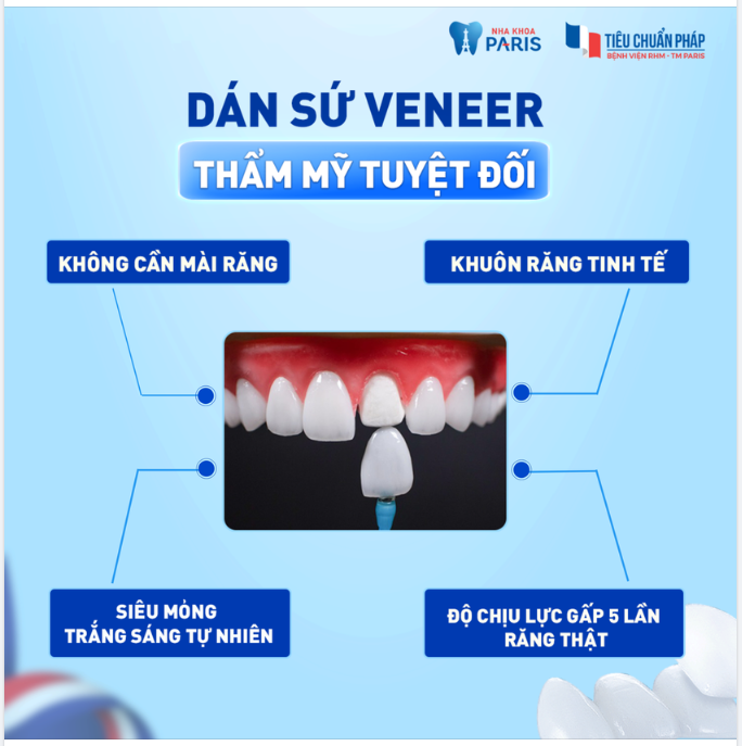 DÁN SỨ VENEER - THẨM MỸ TUYỆT ĐỐI