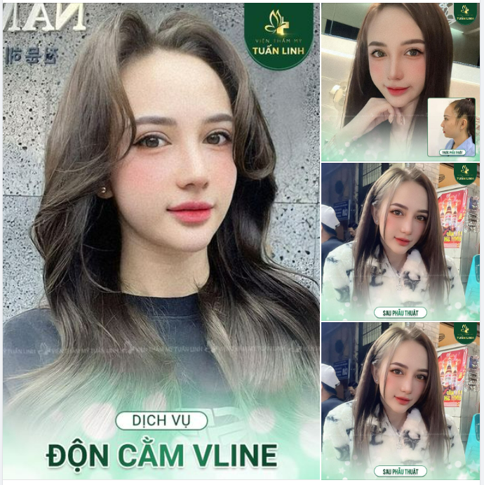 ĐỘN CẰM VLINE - 30 PHÚT HẾT CẰM NGẮN LẸM, MIỆNG HÔ