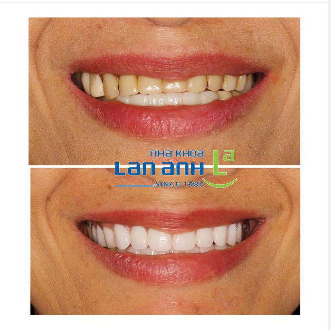 HÀNH TRÌNH TÌM LẠI NỤ CƯỜI XINH