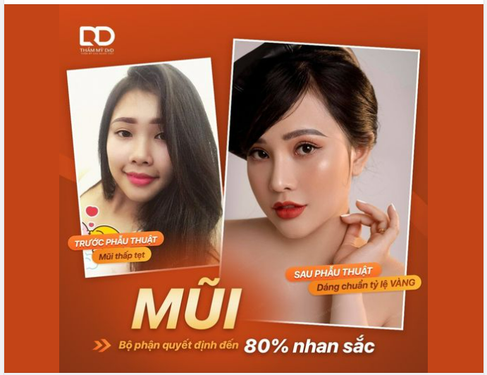 "Mũi là bộ phận quyết định đến 80% nhan sắc"