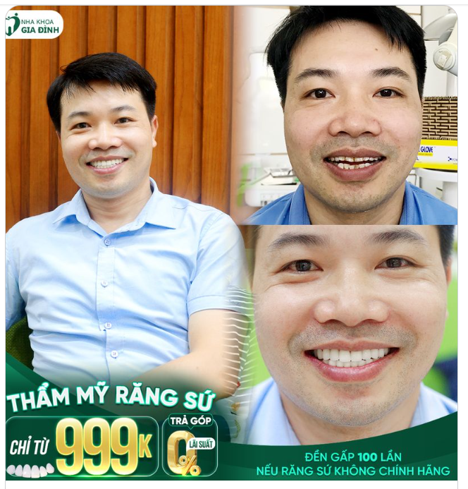 AI CŨNG PHẢI BẤT NGỜ VỀ HÀM RĂNG MỚI CỦA ANH ẤY