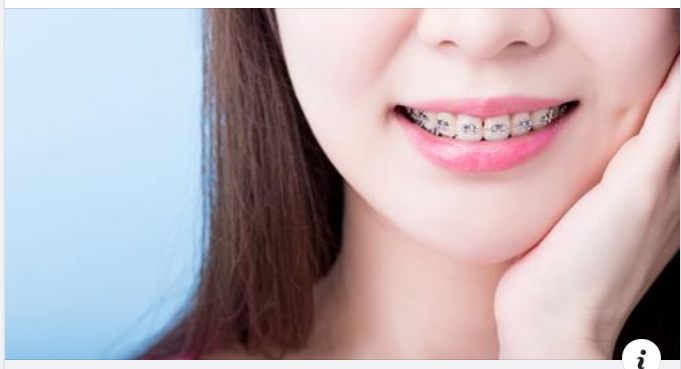 Thời điểm vàng để niềng răng cho trẻ