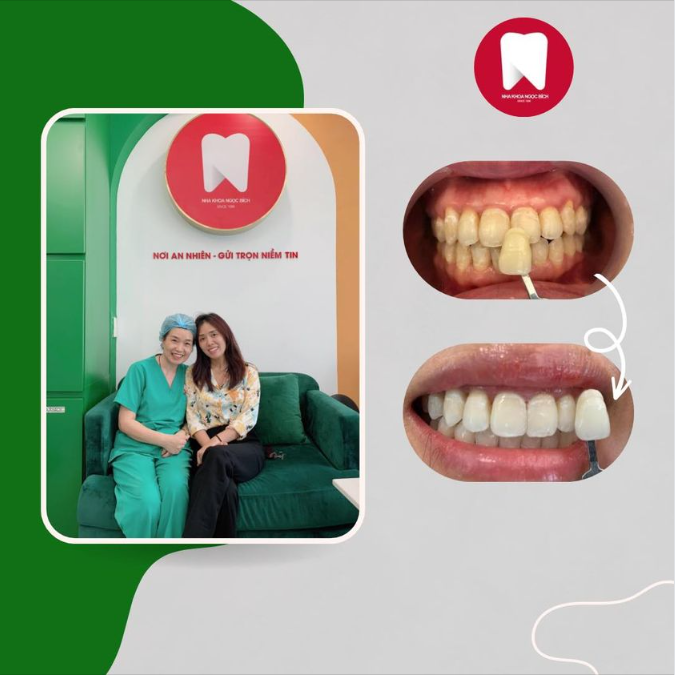 Cảm ơn khách hàng đã trao cho Nha Khoa Ngọc Bích cơ hội được chăm sóc sức khoẻ răng miệng và giúp khách hàng có nụ cười tự tin hơn