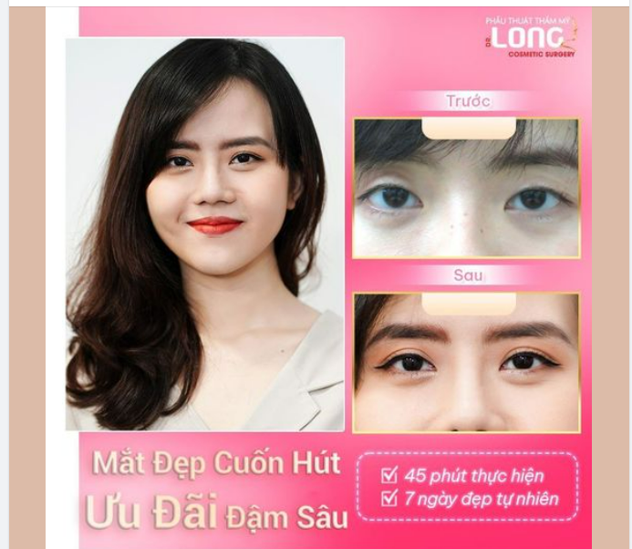 MẮT ĐẸP GIÁ NHẸ NHÀNG CÙNG NÀNG TỎA SÁNG