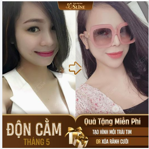 ĐỘN CẰM THẦN THÁI - CHUẨN TỈ LỆ VÀNG