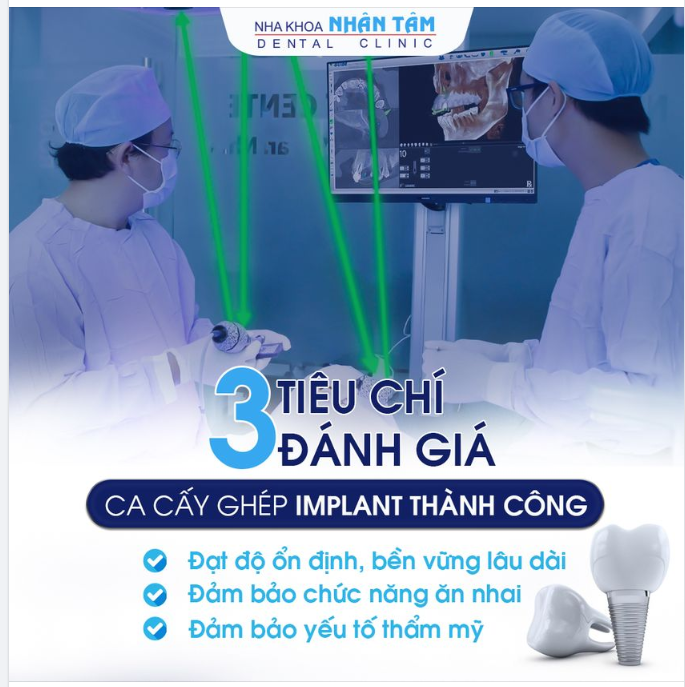 3 TIÊU CHÍ ĐÁNH GIÁ CA CẤY GHÉP IMPLANT THÀNH CÔNG